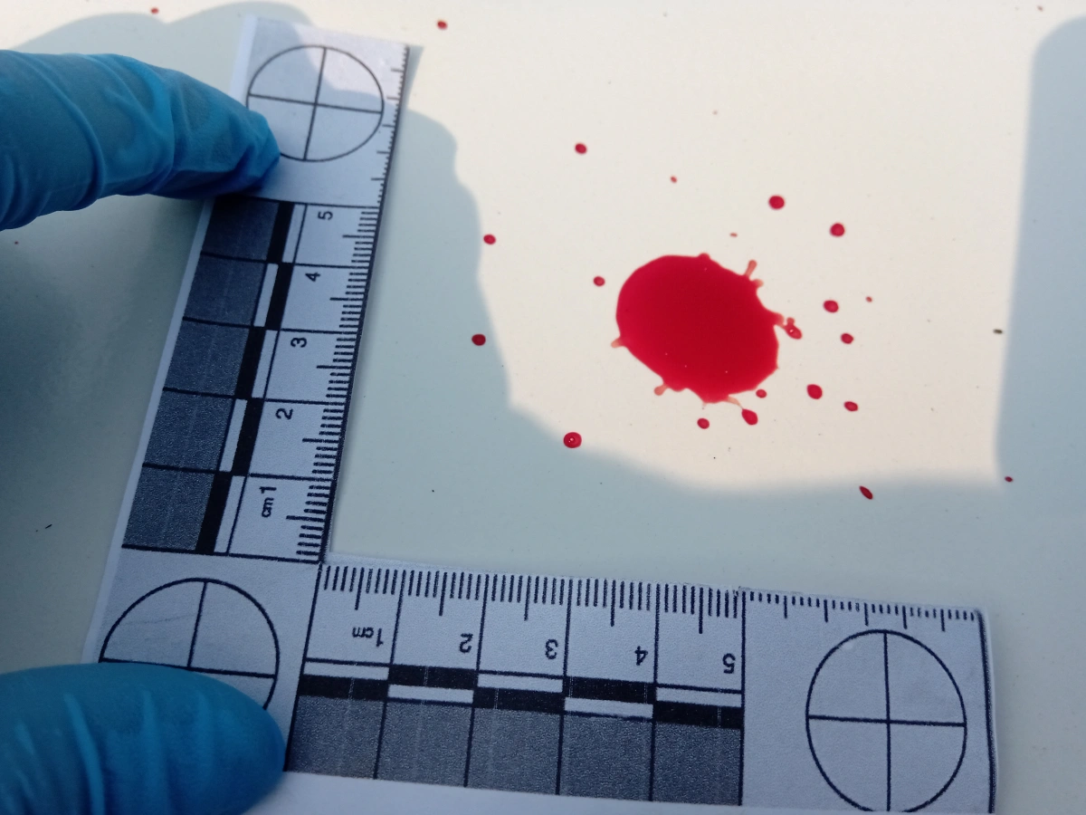 Hematología Forense